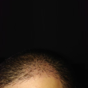 发际线分享社区