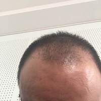 發(fā)際線用戶圖片
