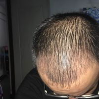發(fā)際線用戶圖片