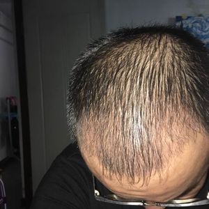 发际线分享社区