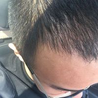 發(fā)際線用戶圖片