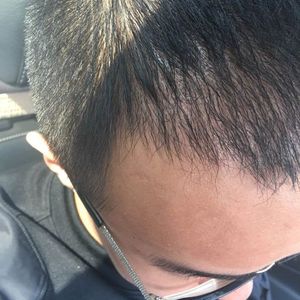 发际线分享社区