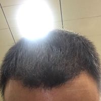 發(fā)際線用戶圖片