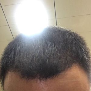 发际线分享社区