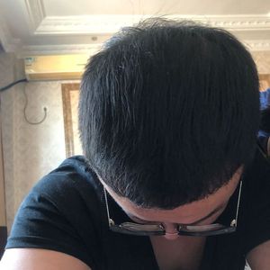 发际线分享社区