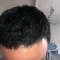 發(fā)際線用戶圖片