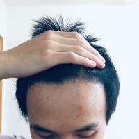 發(fā)際線用戶圖片