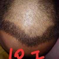 發(fā)際線用戶圖片