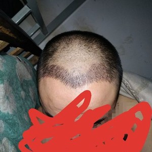发际线分享社区