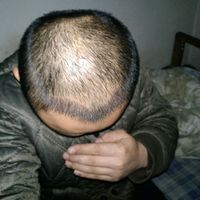 發(fā)際線用戶圖片