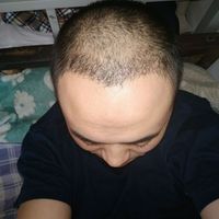 發(fā)際線用戶圖片