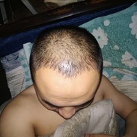 發(fā)際線用戶圖片