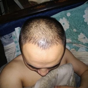 发际线分享社区