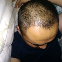 發(fā)際線用戶圖片