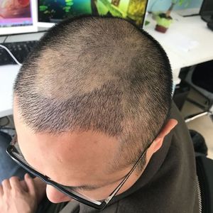 发际线分享社区
