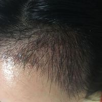 生發(fā)養(yǎng)護(hù)用戶圖片