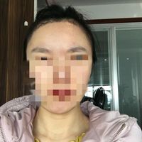 發(fā)際線用戶圖片