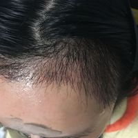 發(fā)際線用戶圖片