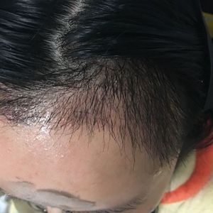 发际线分享社区