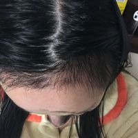 發(fā)際線用戶圖片