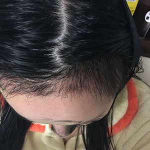 发际线分享社区