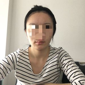 发际线分享社区