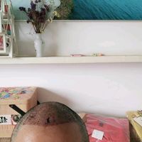發(fā)際線用戶圖片