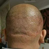 發(fā)際線用戶圖片