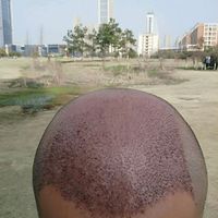 發(fā)際線用戶圖片