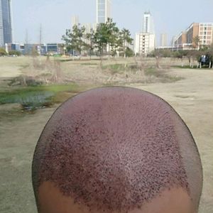 发际线分享社区