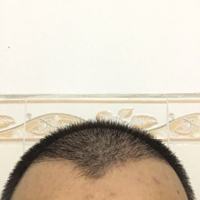 發(fā)際線用戶圖片