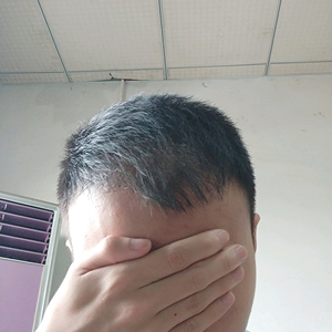 发际线分享社区