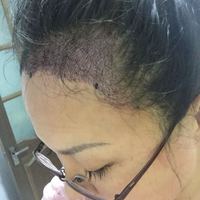 發(fā)際線(xiàn)用戶(hù)圖片