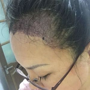 发际线分享社区