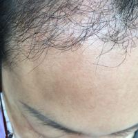 發(fā)際線(xiàn)用戶(hù)圖片