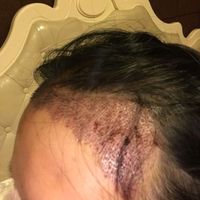 發(fā)際線(xiàn)用戶(hù)圖片