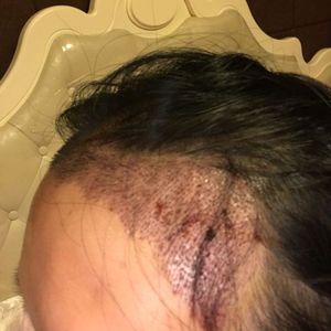 发际线分享社区