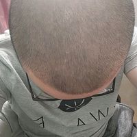 發(fā)際線用戶圖片