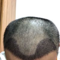 發(fā)際線用戶圖片