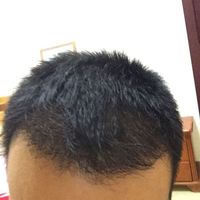 發(fā)際線用戶圖片