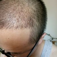 發(fā)際線用戶圖片