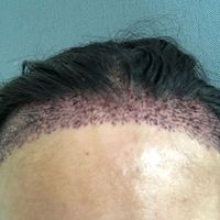 發(fā)際線用戶圖片
