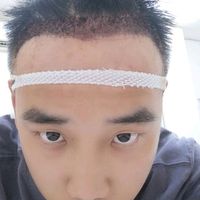 發(fā)際線用戶圖片
