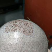 禿頂用戶圖片