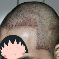 發(fā)際線用戶圖片