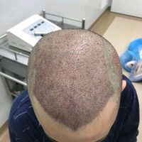發(fā)際線用戶圖片