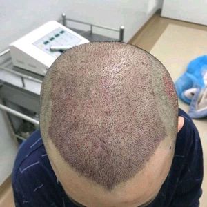 发际线分享社区