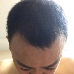 发际线分享社区