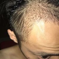 發(fā)際線用戶圖片
