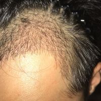 發(fā)際線用戶圖片